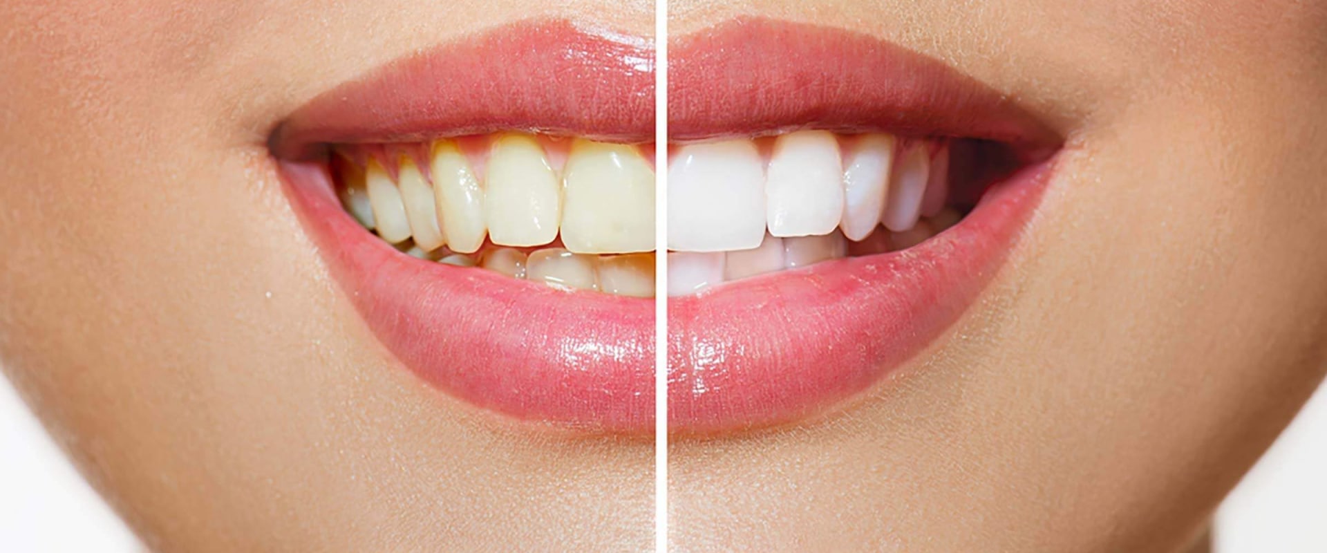 Can Yellow Teeth Turn White Again? A Comprehensive Guide