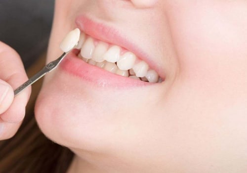 What Are the Negative Side Effects of Teeth Whitening?