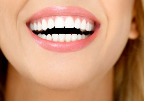 The Best Teeth Whitening Products That Actually Work